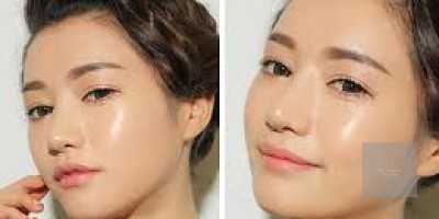 VÉN MÀN NGUYÊN NHÂN KHIẾN DA ĐEN SẠM